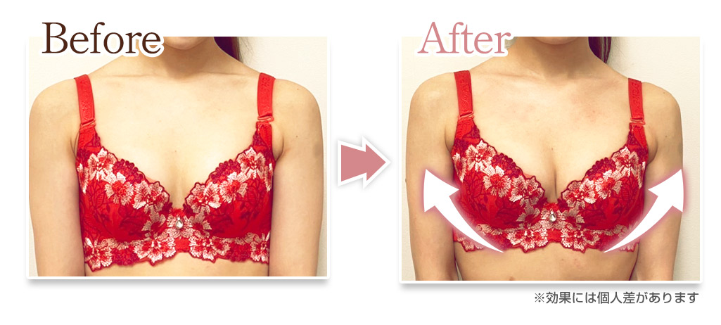 バストアップビフォーアフター