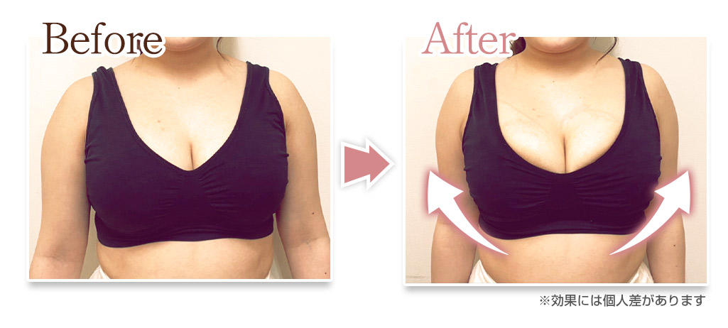 バストアップビフォーアフター